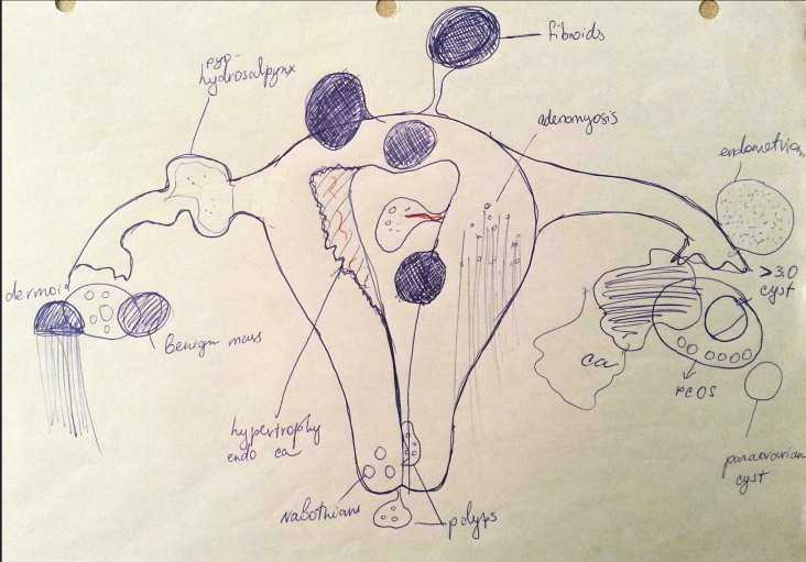 Visual Guide to pelvic pathology﻿